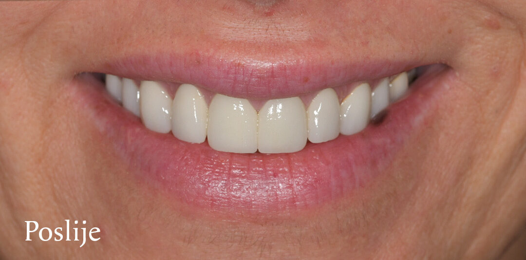 image15